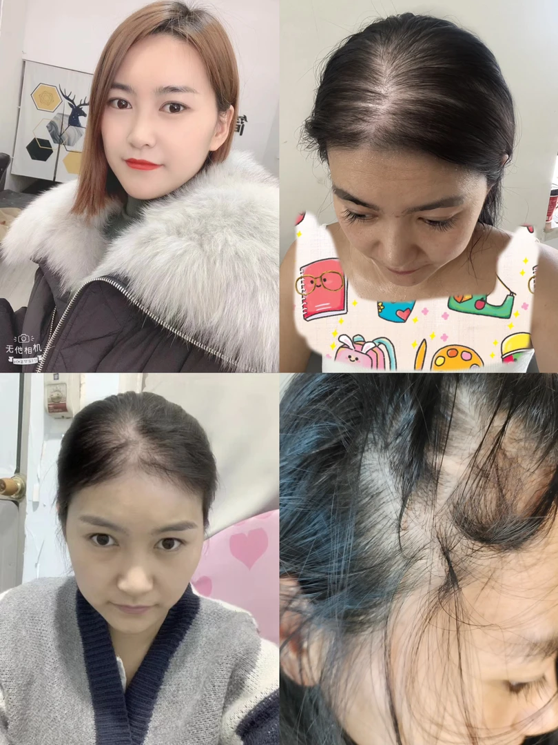 主播以前照片  （梳