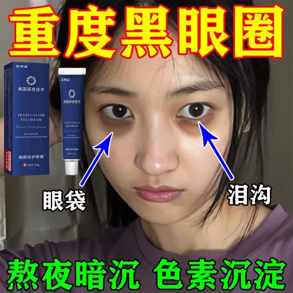 【告别眼袋】黑眼圈眼袋眼纹长期熬夜有泪沟黑色素沉淀熊猫眼鱼尾纹