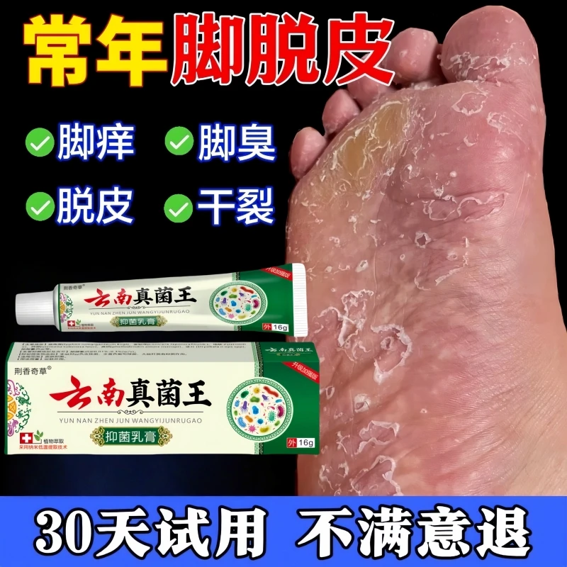 【云南真菌王】脚痒脚臭止痒膏脚趾缝烂痒脱皮抑菌开裂克星专用软膏