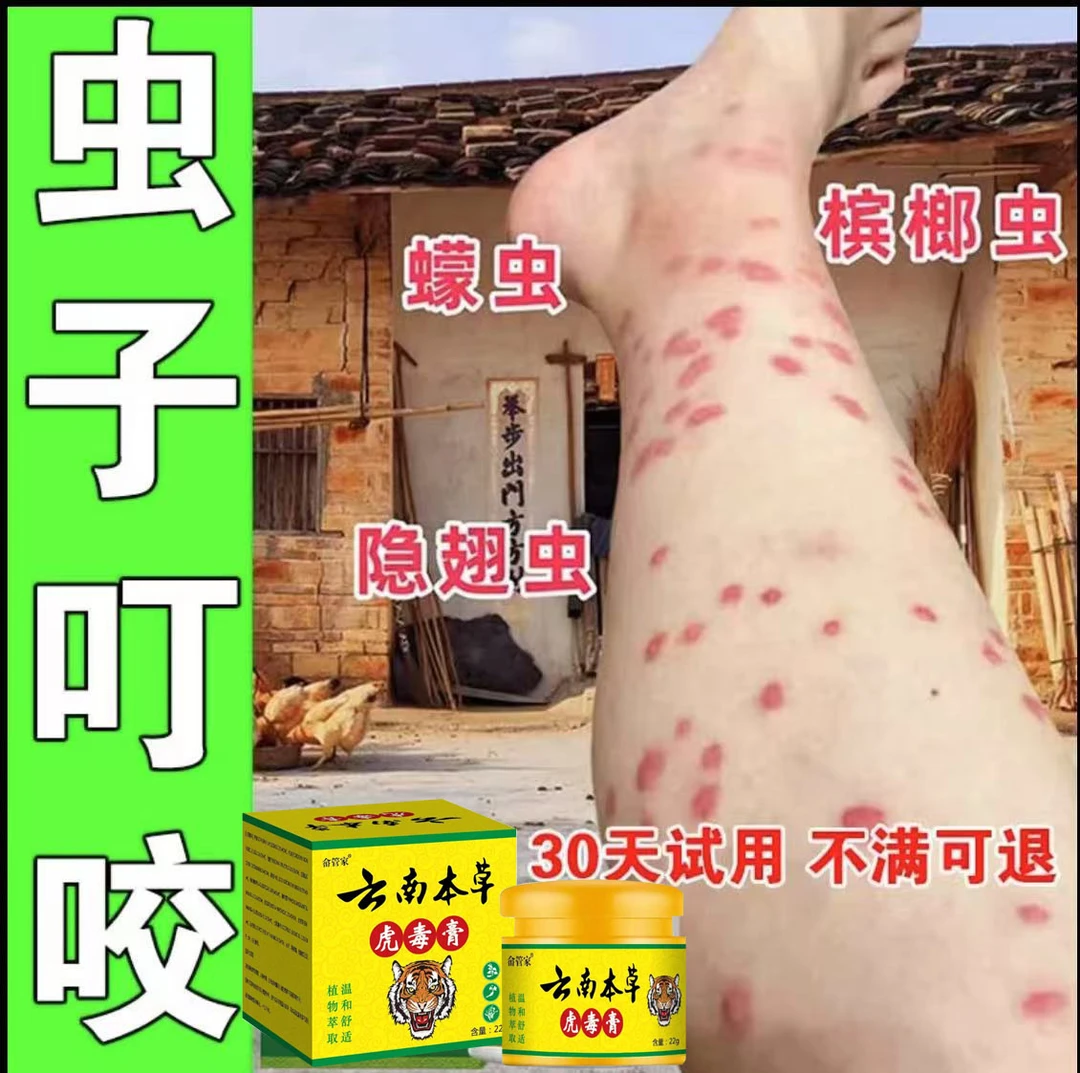 蚊虫叮咬止痒膏消肿毒虫臭虫蚂蚁跳蚤咬成人儿童皮肤快速止痒乳膏
