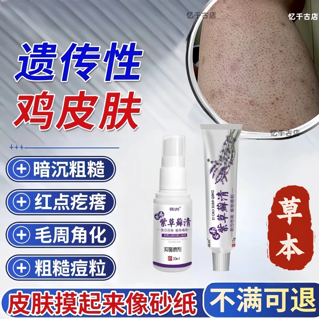 毛囊角化去鸡皮肤疙瘩果酸身体神器夏去除角质鱼鳞蛇霜干燥起皮