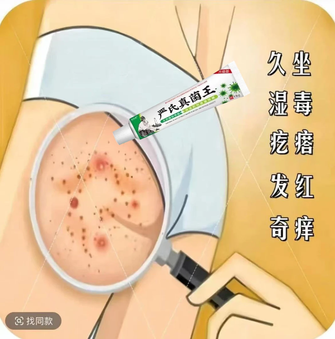 屁股【臀部】上长疙瘩痘痘久坐痒止痒膏刺挠红点抑菌乳膏