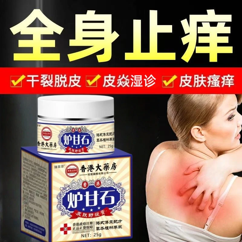【香港大薬房】炉甘石皮肤瘙痒皮焱荨麻/疹湿诊痒脚/气红斑身体护理