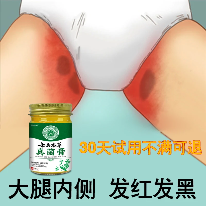 大腿内侧发红发黑长痘痘疙瘩阴囊湿痒大腿根痒止痒私处真菌王乳膏