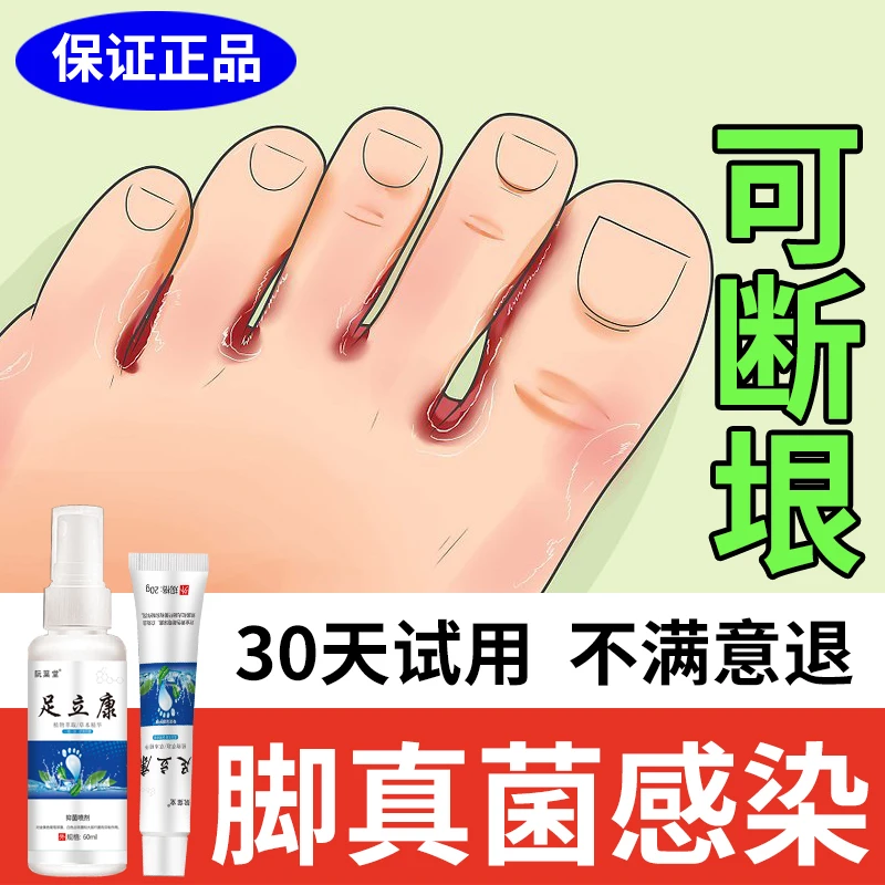 脚痒脚臭专用抑菌喷雾剂止痒神器干裂脱皮汗脚起水泡脚趾缝痒克星