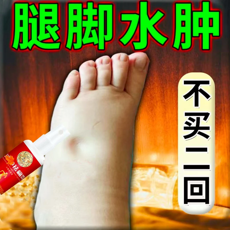 腿脚水肿专用喷雾四肢浮肿大小腿肿老人下肢全身水肿脚肿穿鞋困难