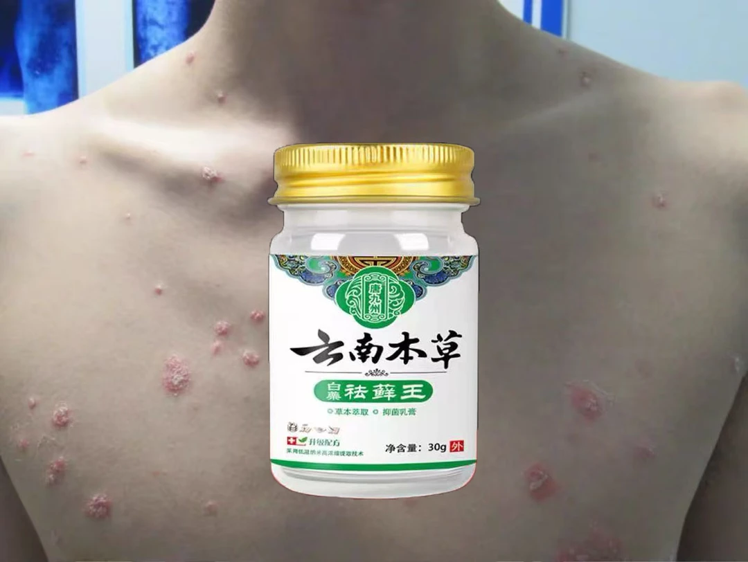 牛皮专用膏银屑止痒膏皮肤止痒正品手鲜脚鲜顽鲜外用草本膏涂抹膏