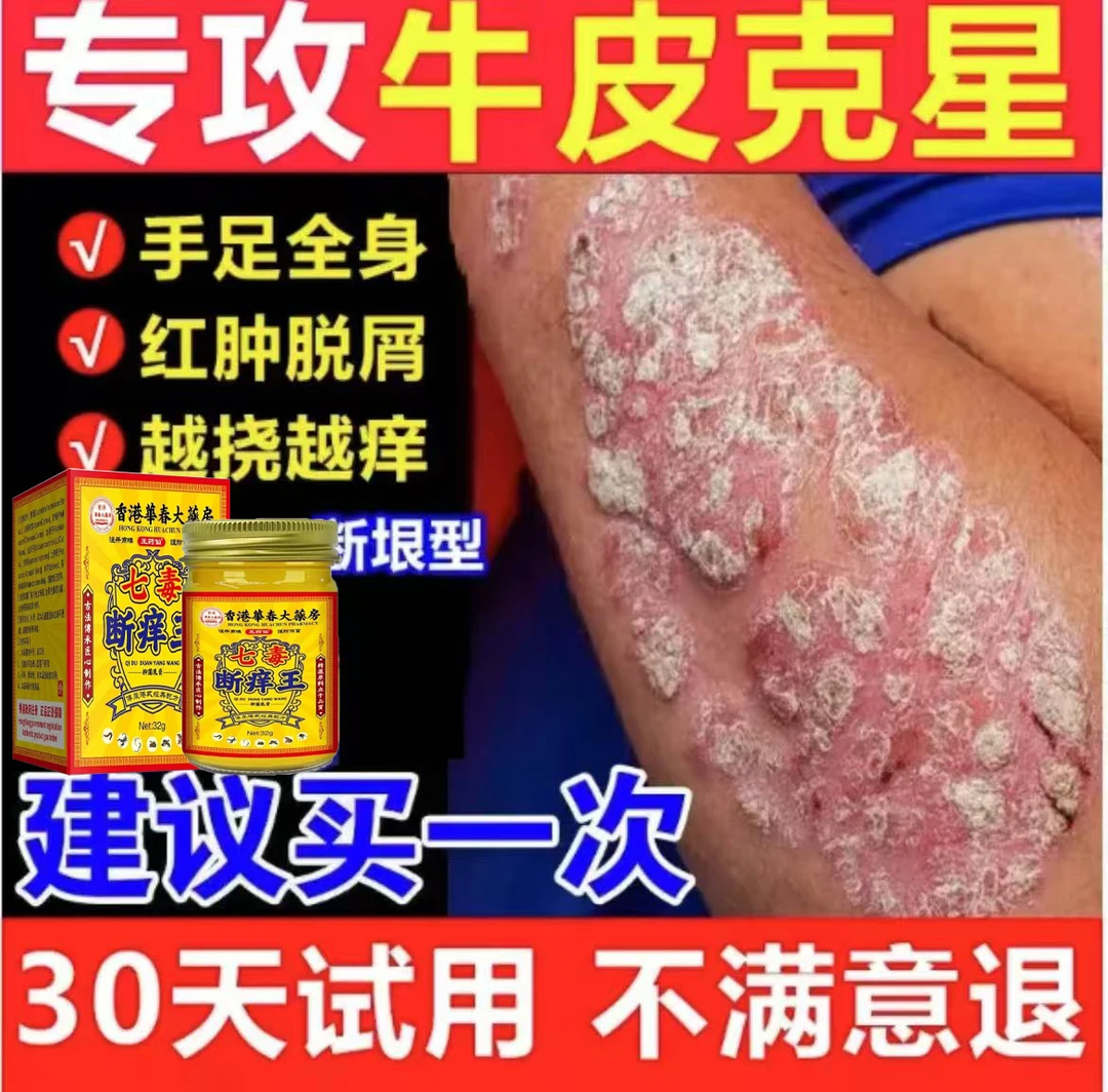 【香港断痒王】全身牛/皮/银/屑/手足头体股大腿内侧止痒癣膏药专用