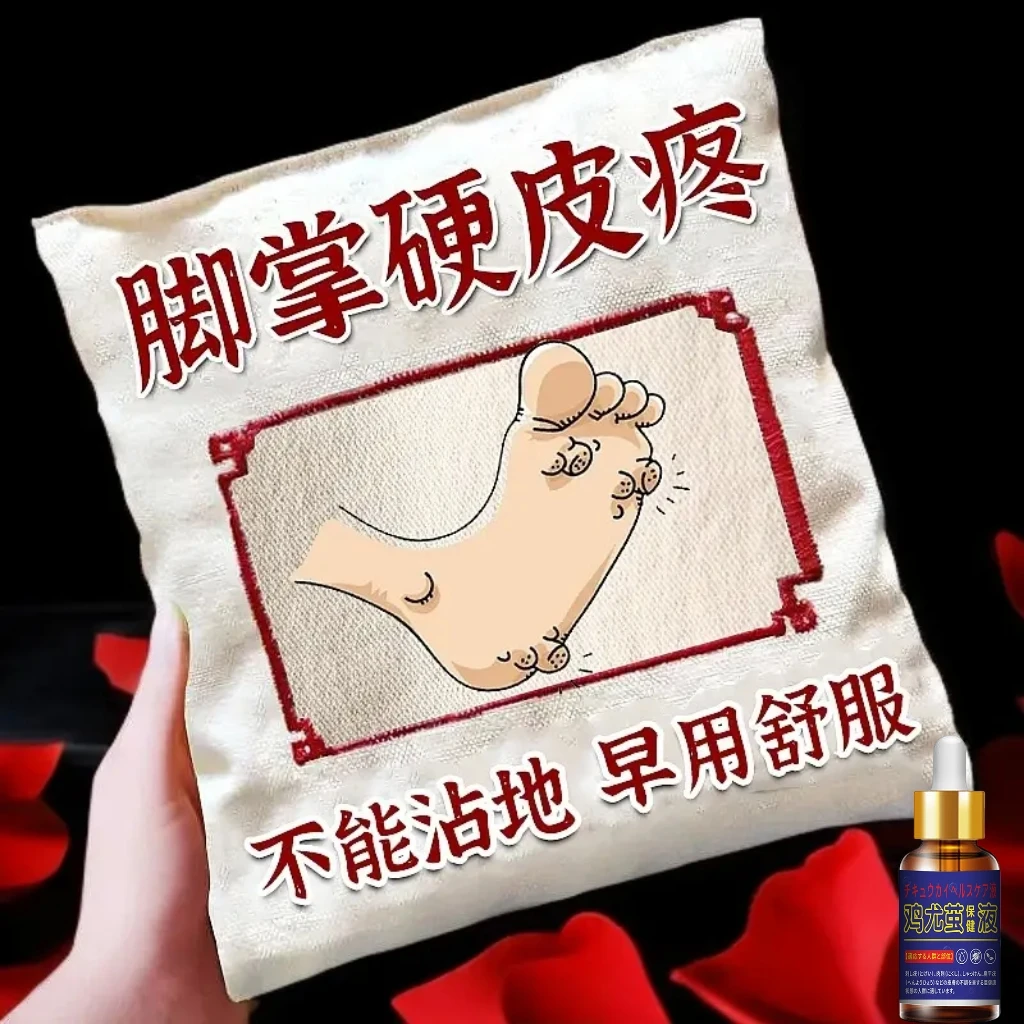 脚趾鸡r去除液上茧神器厚皮脚钉脚垫手脚脚底软化剂