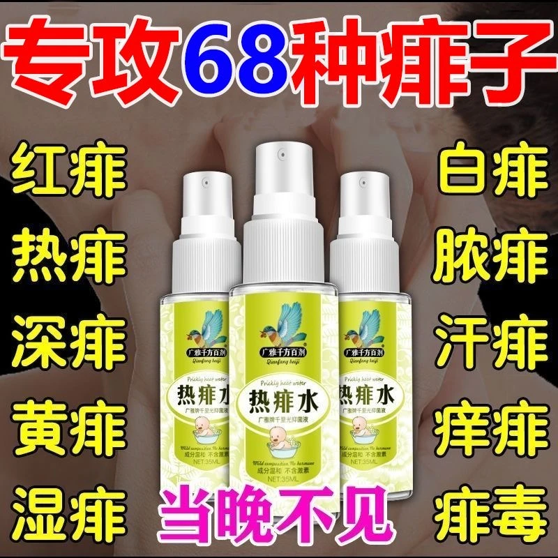 去热痱子水祛痱止痒膏喷雾大人去痱热痱水儿童宝宝成人爽身粉神器