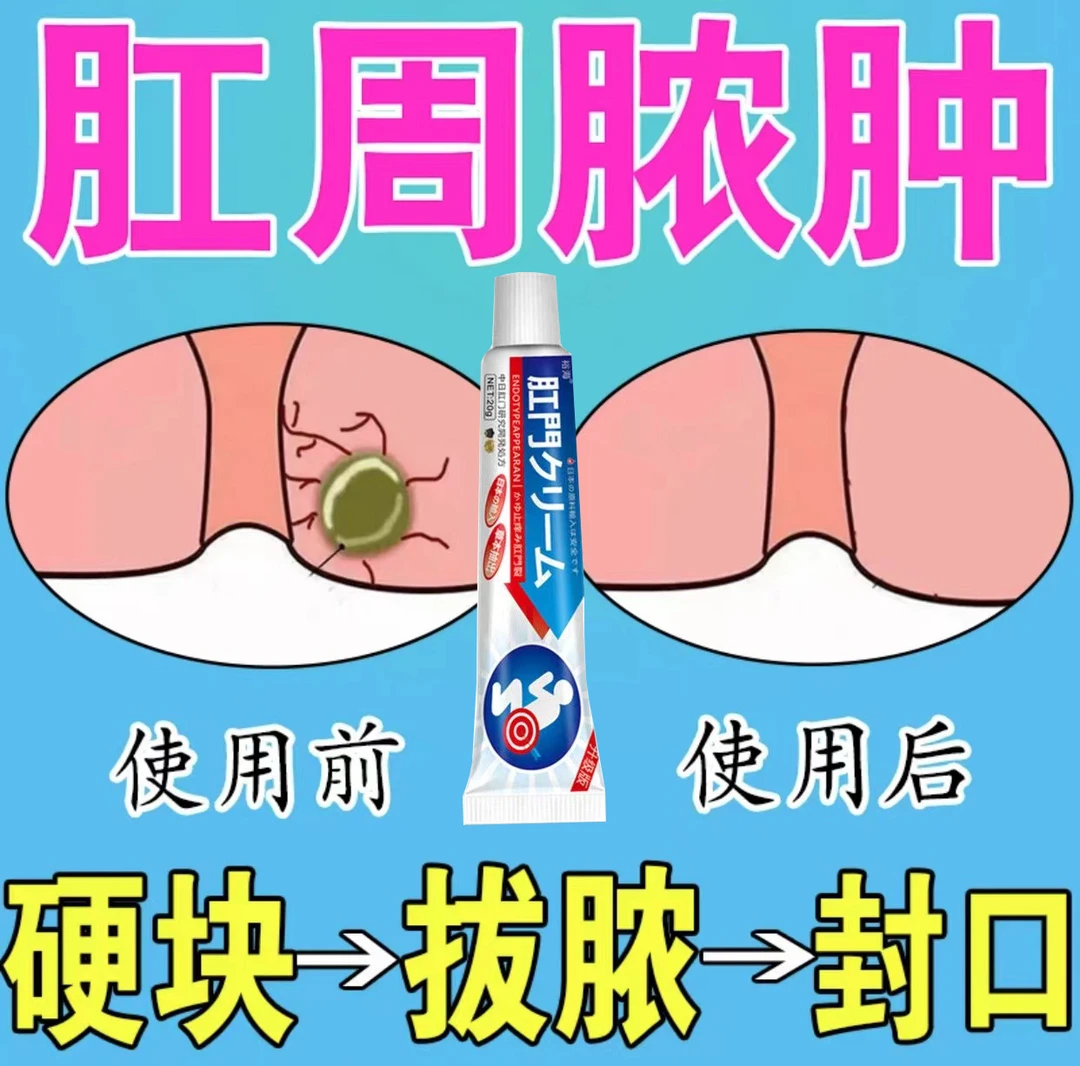 肛周肿软膏肛周肛瘘硬块外口流外用封口膏
