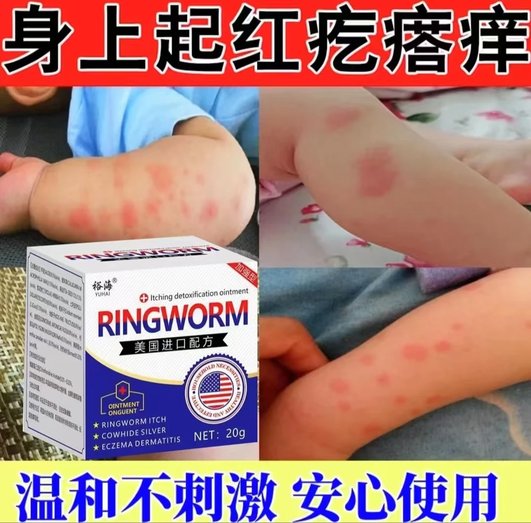 全身皮肤痒手脚痒越抓越痒外用涂抹止痒膏