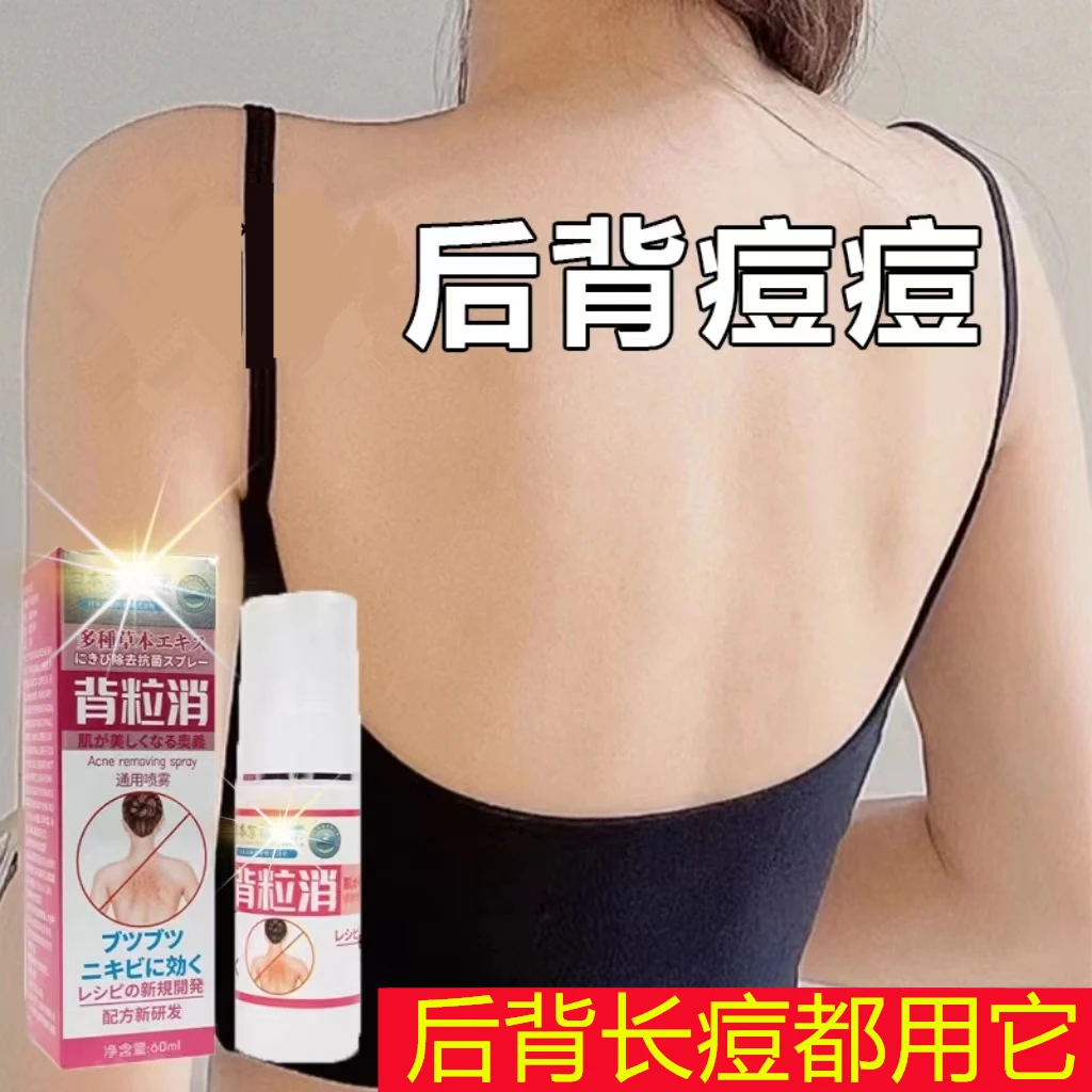 日本京都背粒消喷雾背部淡化痘痘印精华液背粒消痘美背祛痘喷雾剂