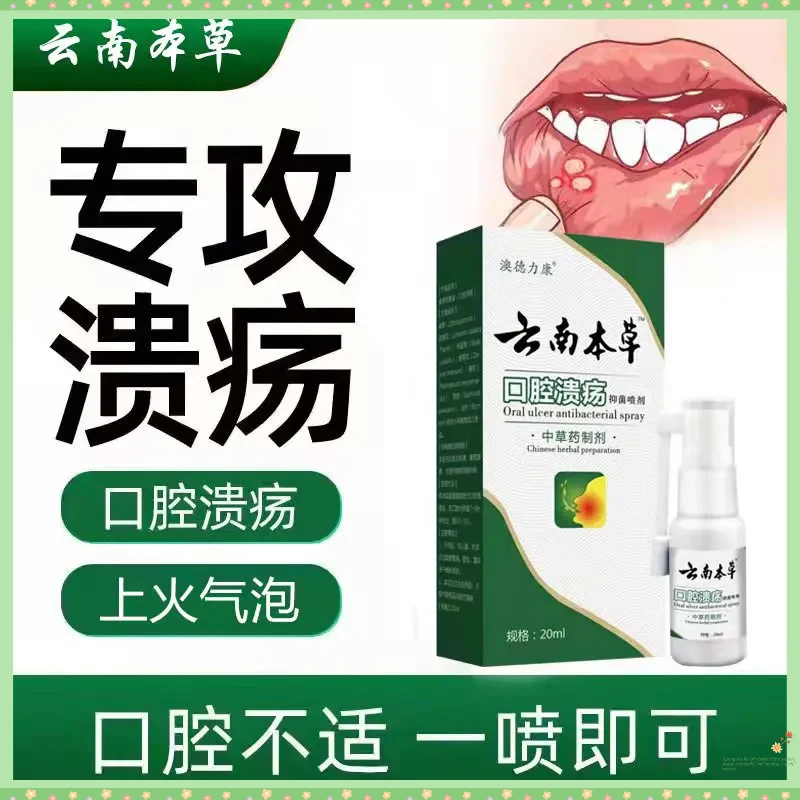 云南本草口腔溃疡喷雾剂温和草本嘴巴上火异味起泡异味痛口舌生疮
