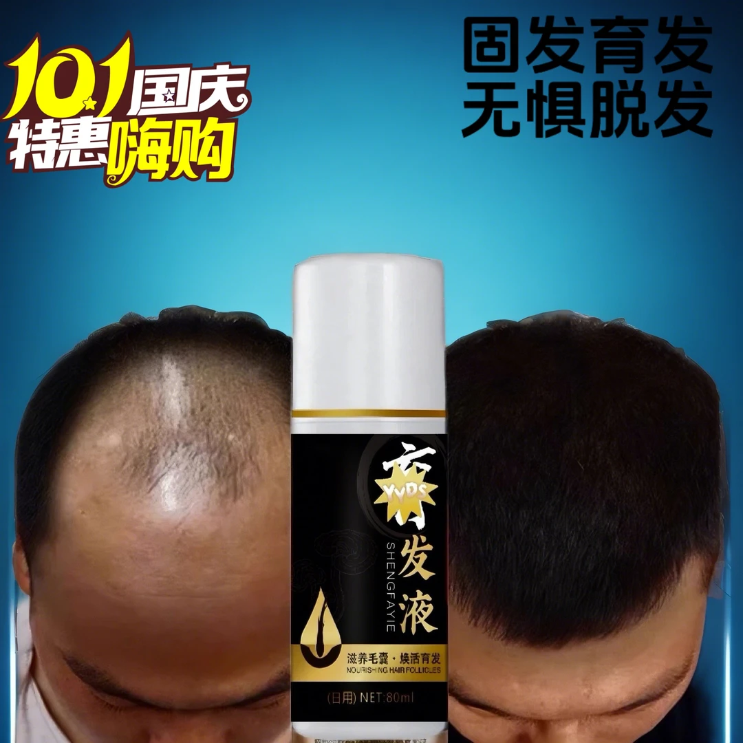 育发液头发际线生长增密头发固发护理日夜用男生毛攘防脱营养剂液