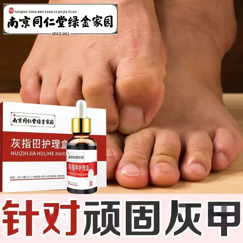 正品凤仙花恢甲抑菌萃取护理盒快速修护草本涂抹增效发黄发黑厚甲