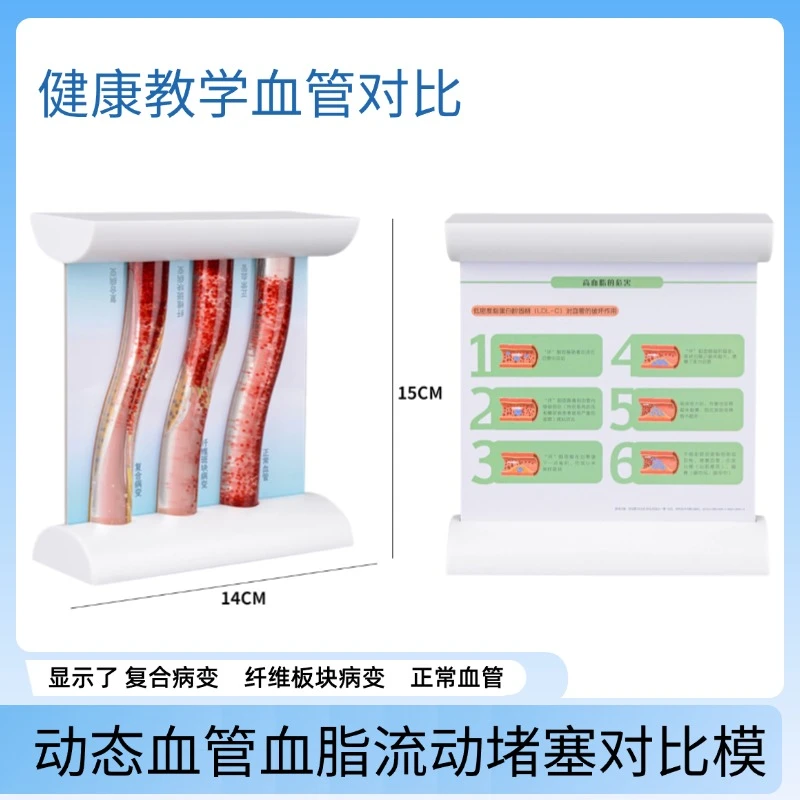 卓越科人体流动变化血管教学模型