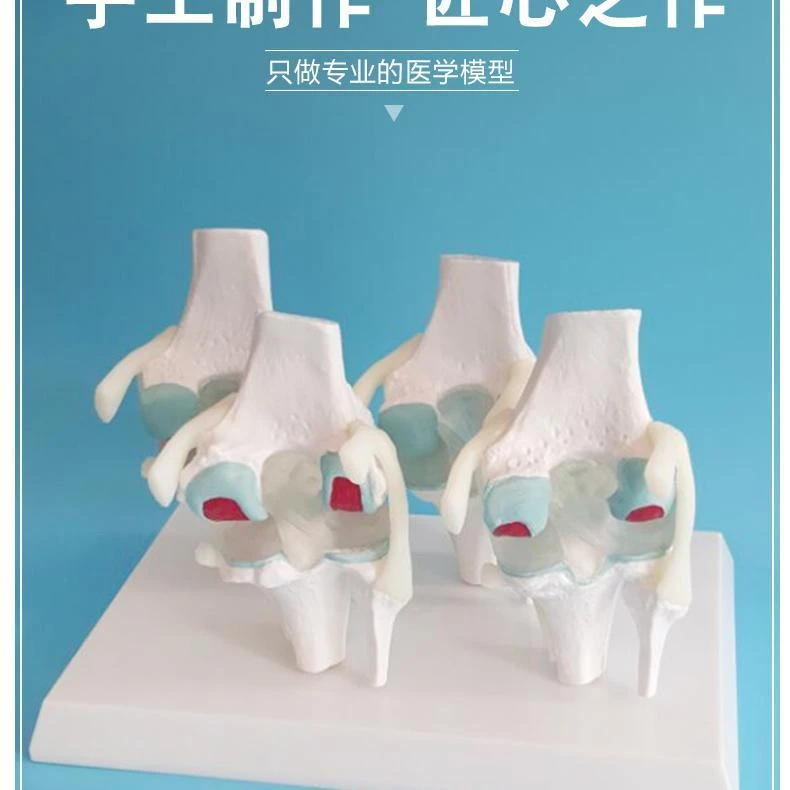 膝关节模型病变膝关节模型骨科教学展示膝盖骨质曾生病理关节