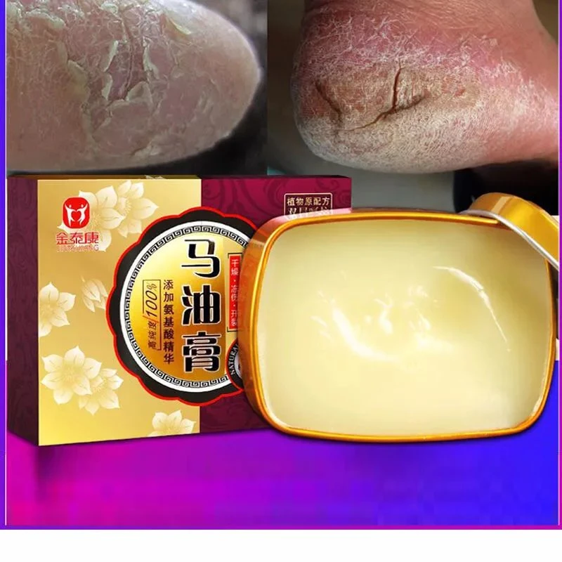 马油修裂膏手脚开裂防冻防干裂口死皮脚后跟足修复护手霜防裂精华