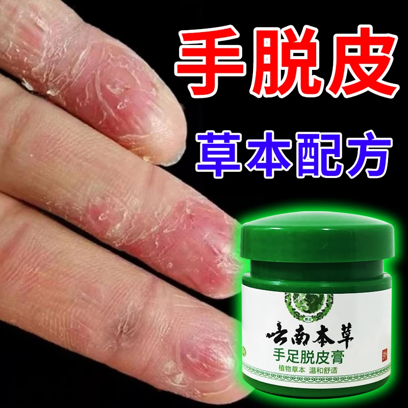 云南本草手足脱皮膏20g/盒 草本萃取涂抹温和外用手脚部脱皮干裂
