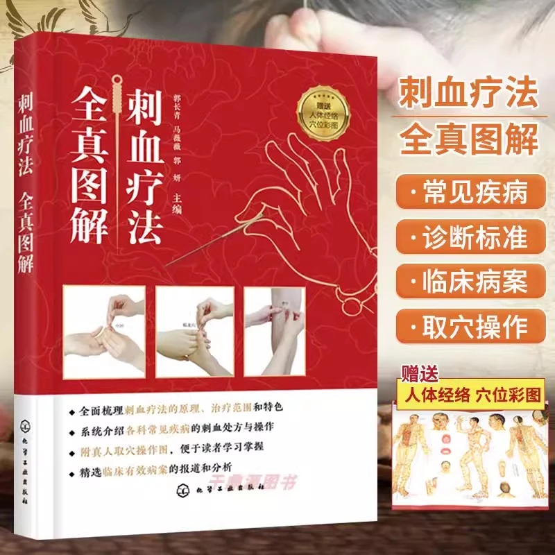 【正版保证】刺血疗法全真图解 HXGY