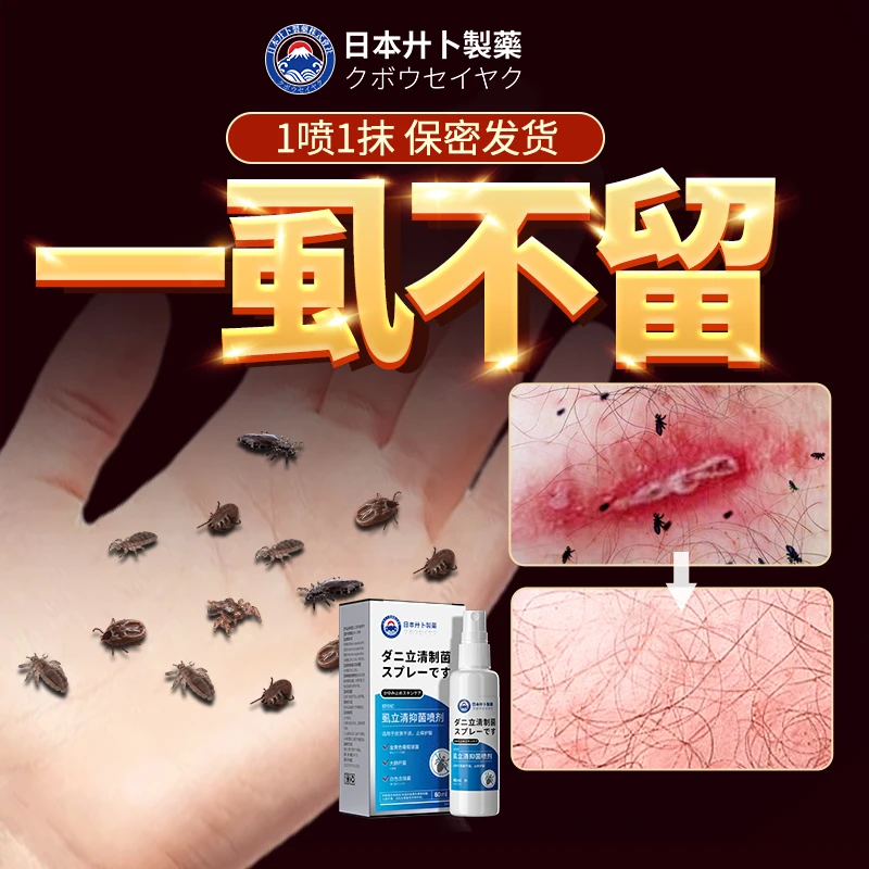 虱立清喷雾免刮毛虱子虱卵一扫光男女通用头虱百部虱立净止痒喷剂