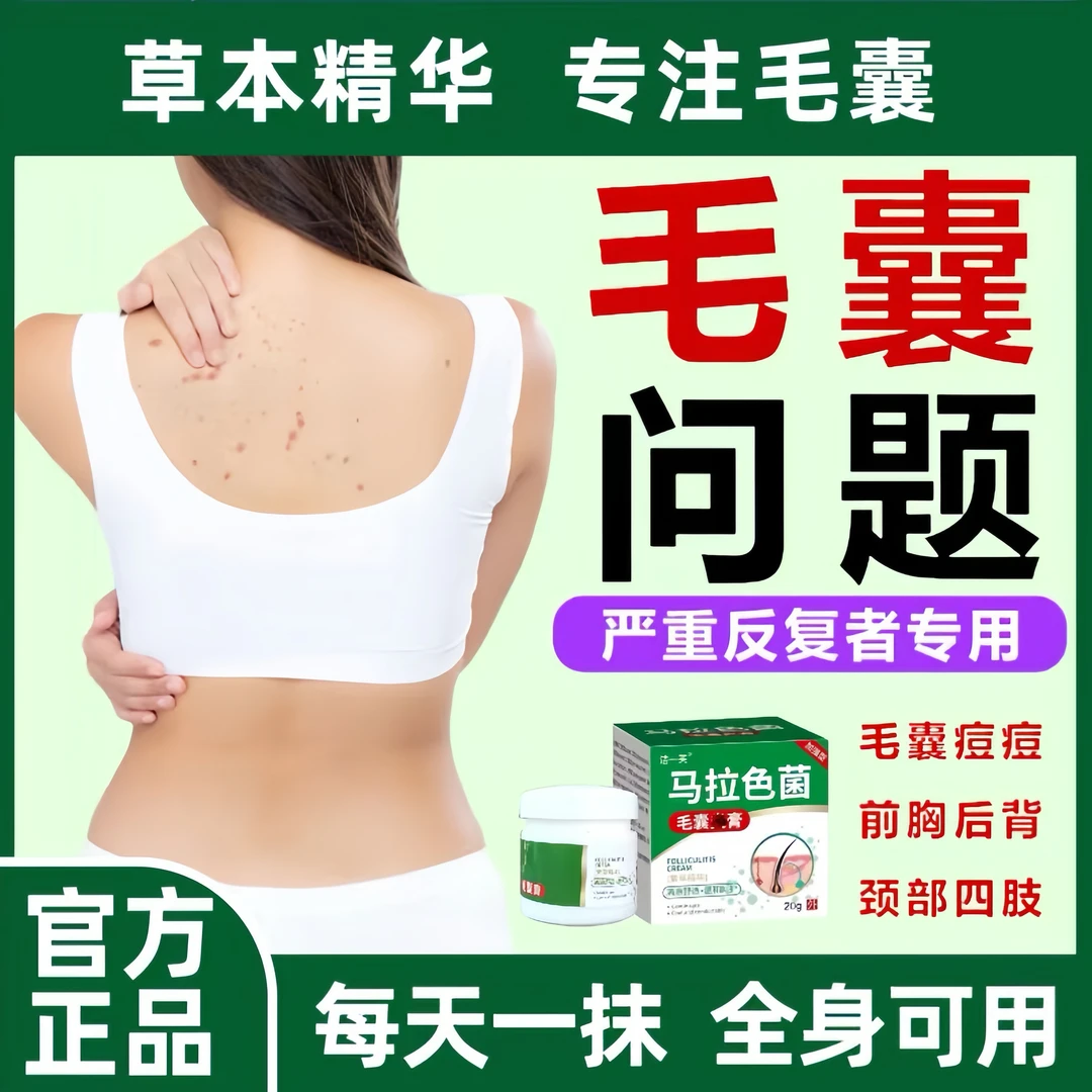 马拉色菌毛囊膏进口前胸后背头皮毛囊小疙瘩红点红痘痘草本抑菌膏