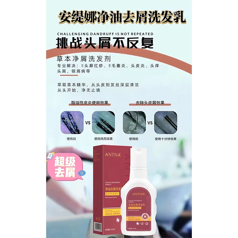【小包快跑】安缇娜净油去屑洗发乳
