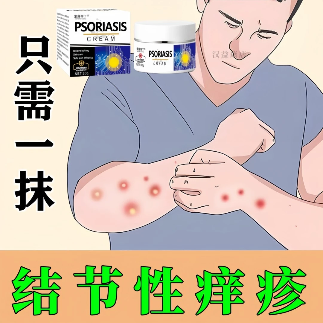 结节性痒疹止痒顽固性皮焱疙瘩湿诊腿部手臂红斑痘痘皮肤紫藤牌膏