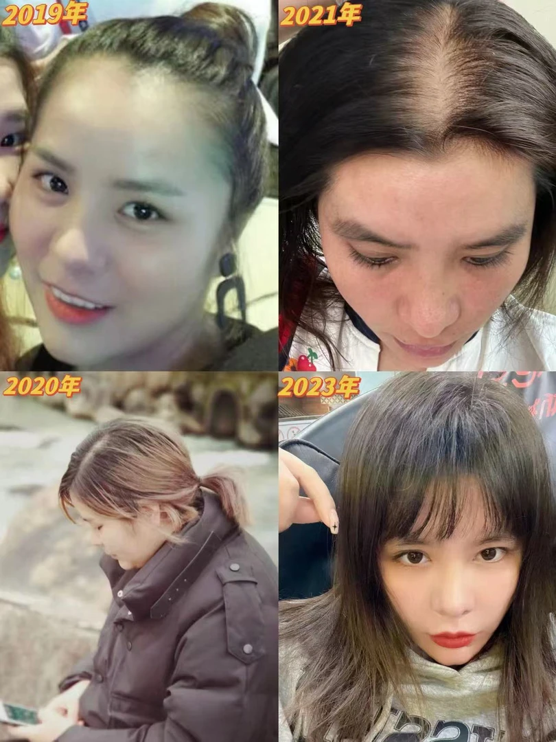 主播使用前(气垫梳)