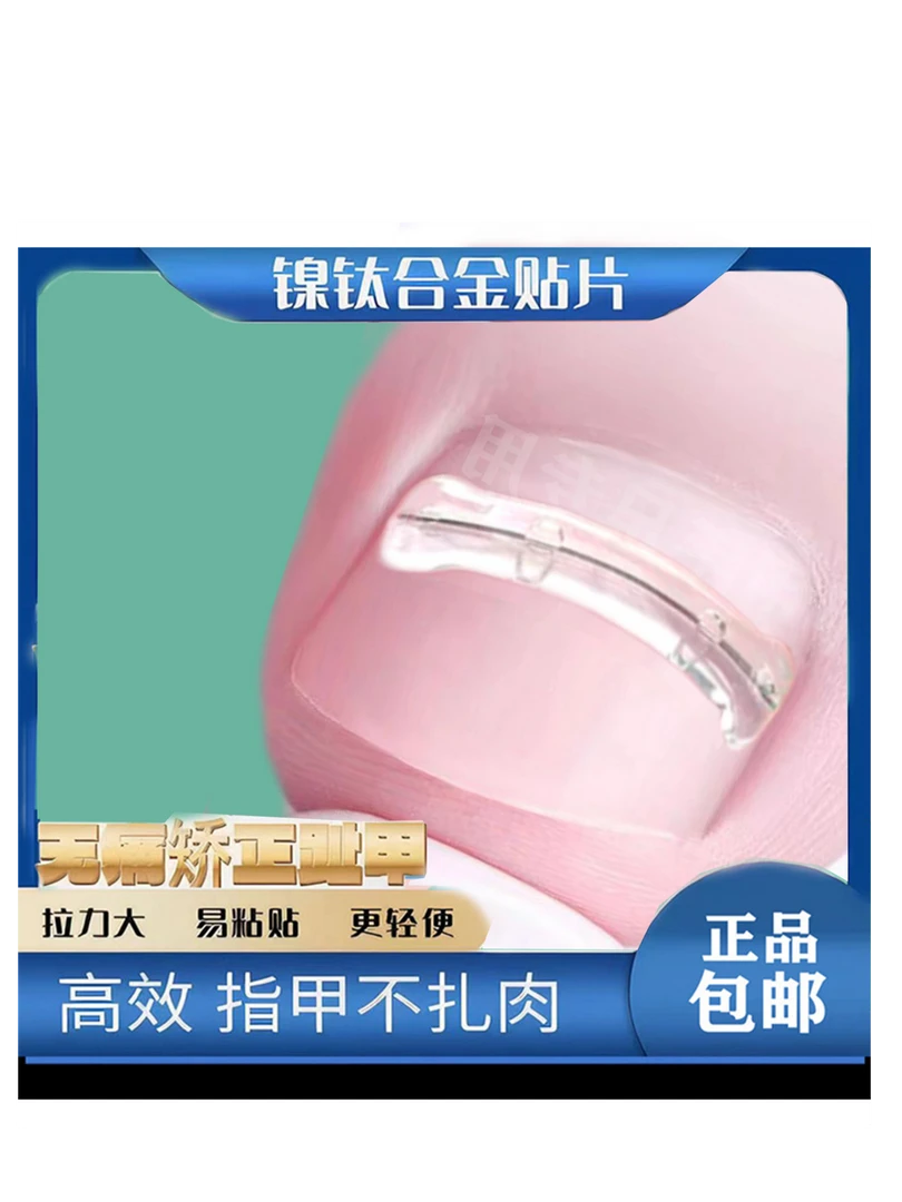 正甲贴嵌甲矫正软胶加记忆回弹丝 好贴不掉甲甲不钻肉