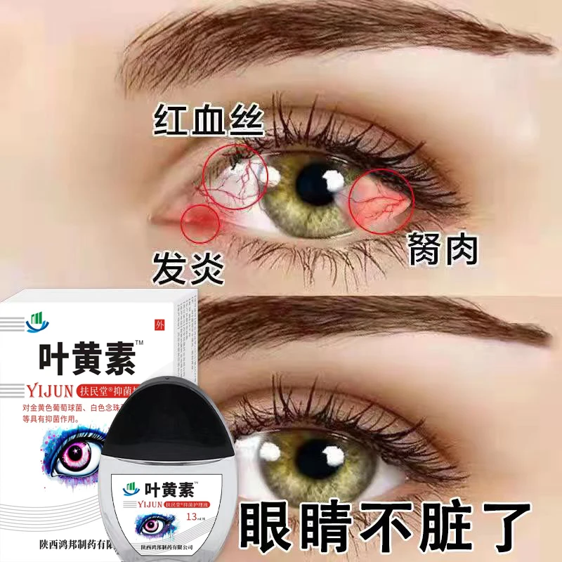 （叶黄素）抑菌滴眼液明目护眼眼部清洁护理液干涩缓解视力模糊舒缓