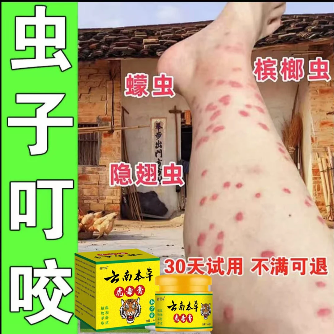 臭虫跳蚤咬蚊虫叮咬止痒消红液蚊子咬儿童成人皮肤草本外用乳膏
