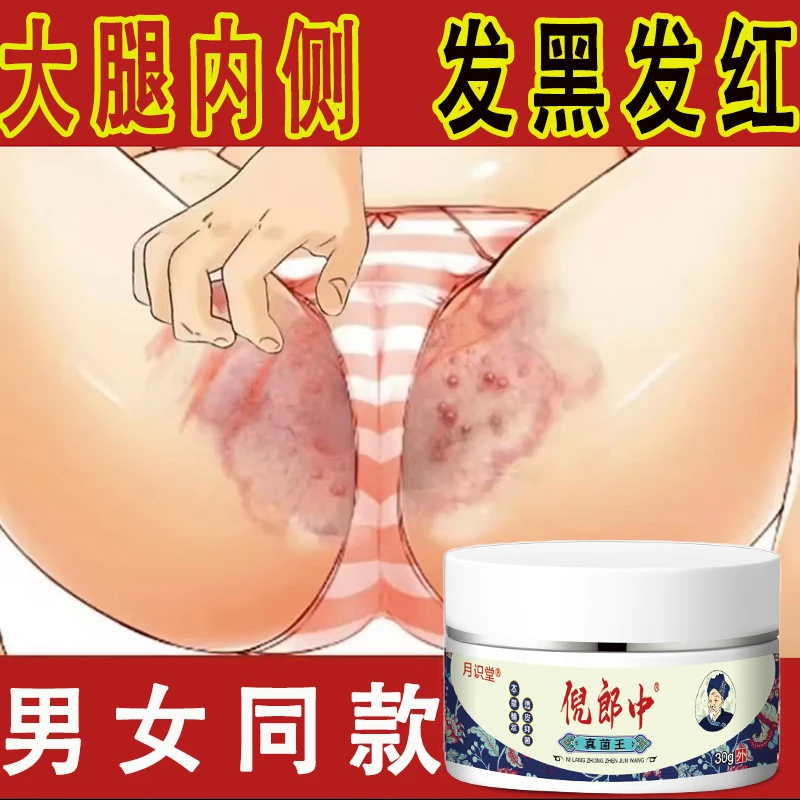 【真菌王】大腿两边止痒膏异味难闻男女同款全身可用草本止痒抑菌膏