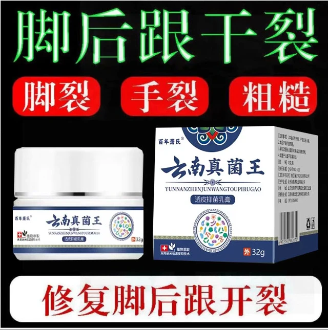 正品云南真菌王脚后跟起皮粗糙干裂起硬皮手开口干裂防裂膏
