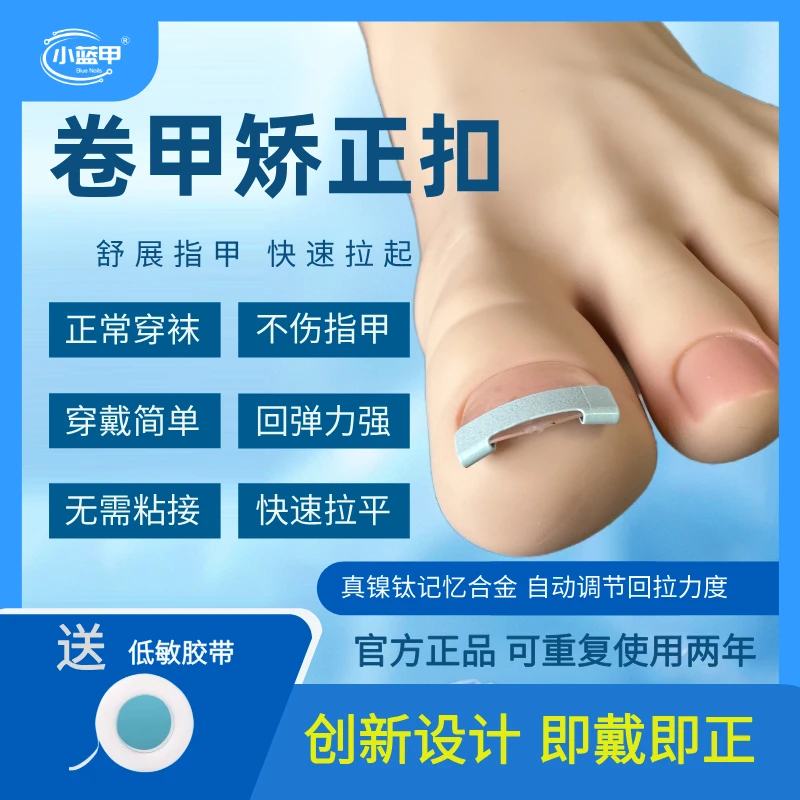 小蓝甲甲沟矫正器贴嵌甲卷甲正甲扣镍钛合金矫正器脚趾甲指甲扎肉
