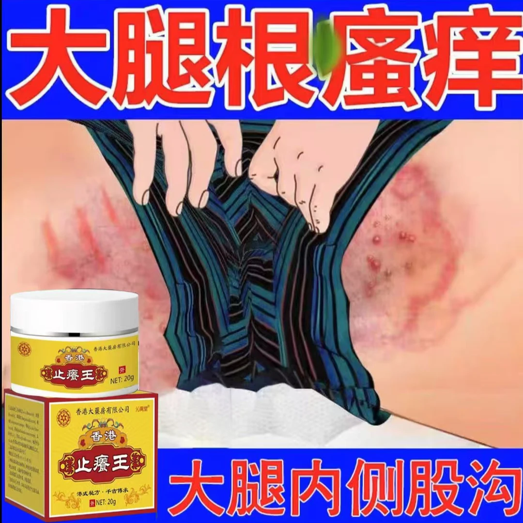 大腿内侧黑痒异味私处根潮湿痒长痘痘腹股沟痒男女通用止痒抑菌膏