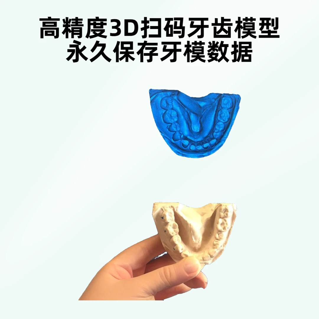 3D扫描-扫描牙齿模型数据 牙齿数据永久保存