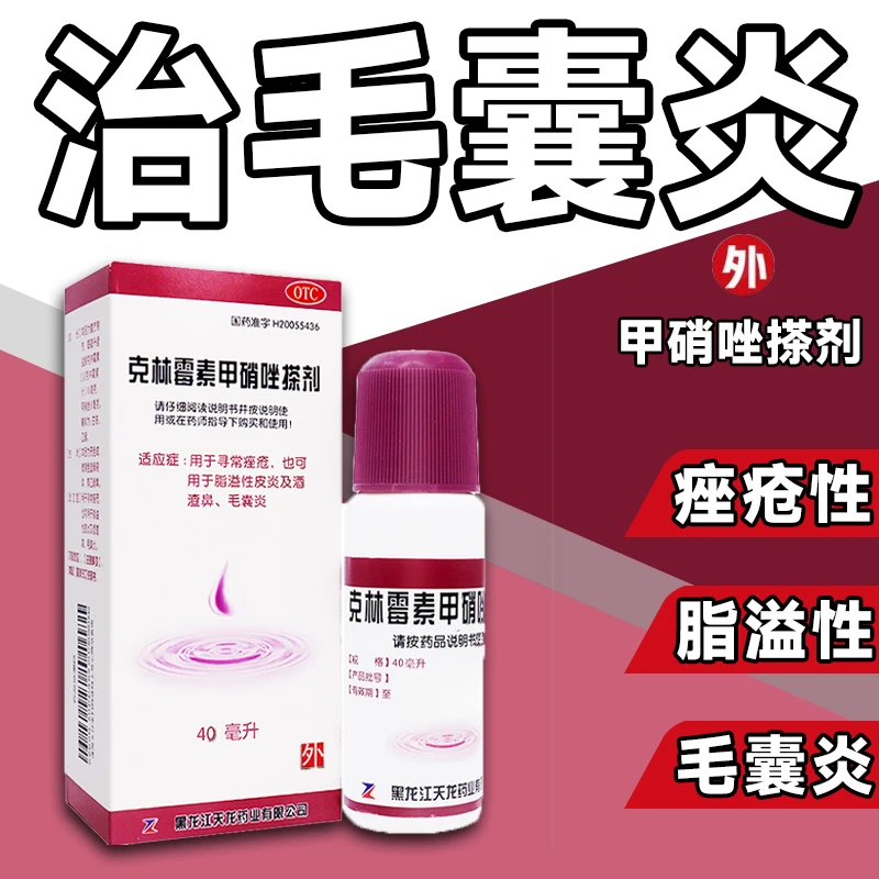 天龙克林霉素甲硝唑搽剂40ml用于毛囊炎脂溢性皮炎酒渣鼻  痤疮 豆豆