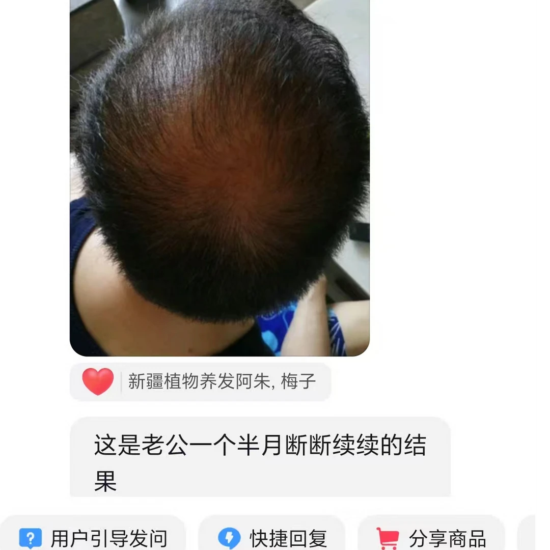 阿伊苏护发油（黑眉油）反馈合集养发护理