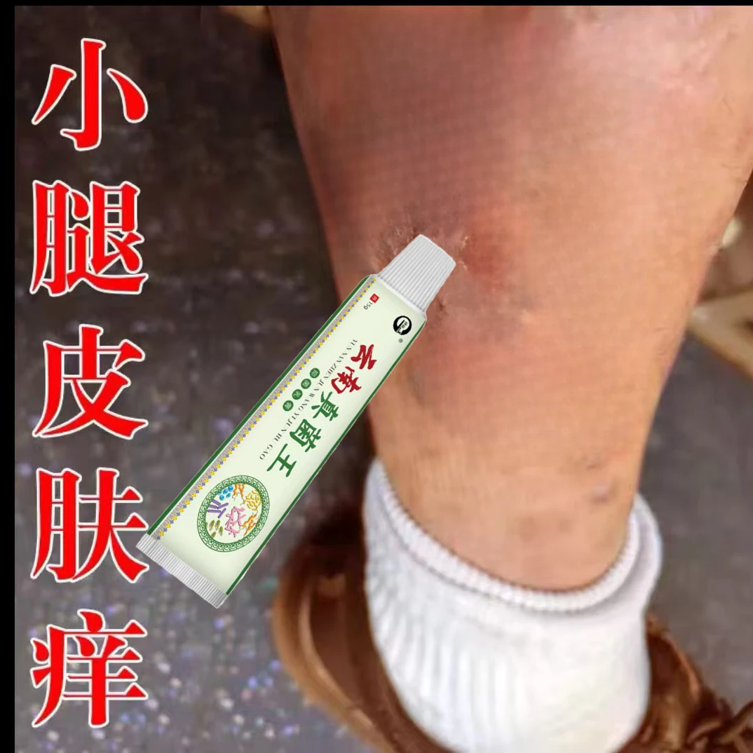 腿上干燥起皮小腿皮肤痒秋冬腿部瘙痒越抓越痒止痒抑菌专用膏
