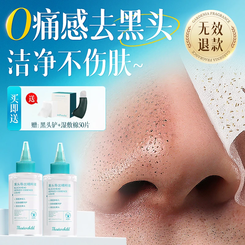 祛黑头导出液清洁收缩毛孔溶解粉刺闭口角质男女官方正品牌旗舰店