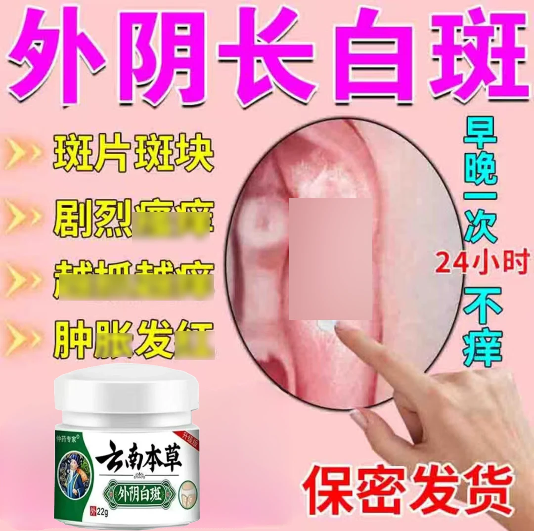 【外阴白斑】外阴白斑止痒修复膏