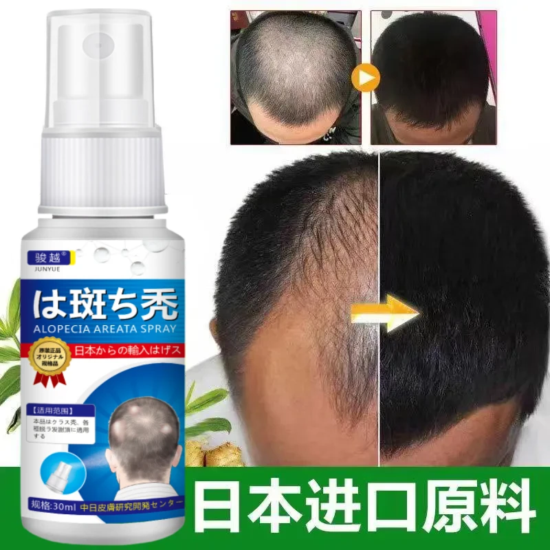 外用鬼剃头喷剂日本斑秃压力熬夜脱发秃头谢顶专用涂抹草本喷雾