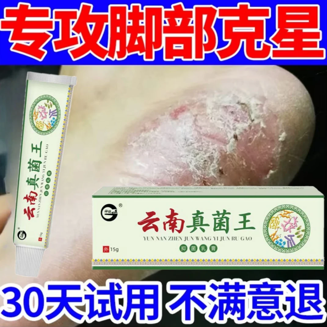 《云南真菌王》脚起皮脚脱皮修复膏脚后跟开裂皲裂防裂止痒膏