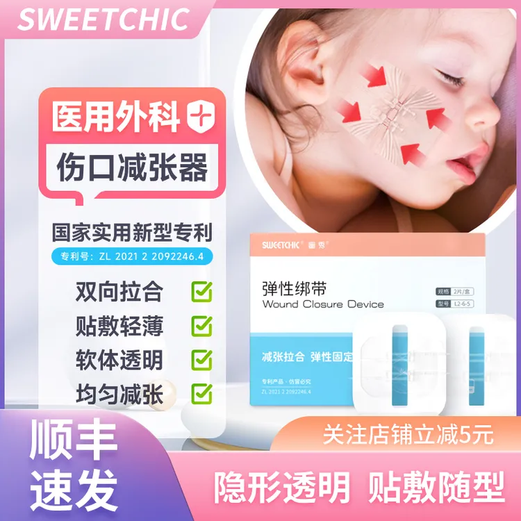 SWEETCHIC蜜秀医用减张器减张贴免缝针缝合胶布拉链式拉合弹性绑带