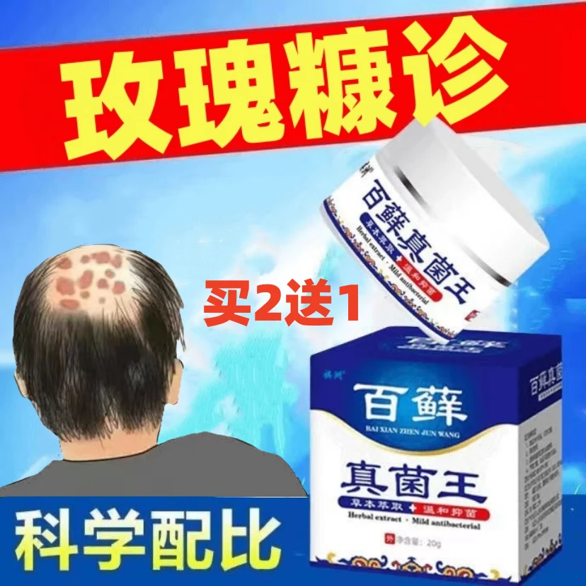 玫瑰糠诊止痒膏皮肤瘙痒背后手臂腿上成片红斑草本止痒外用涂抹膏
