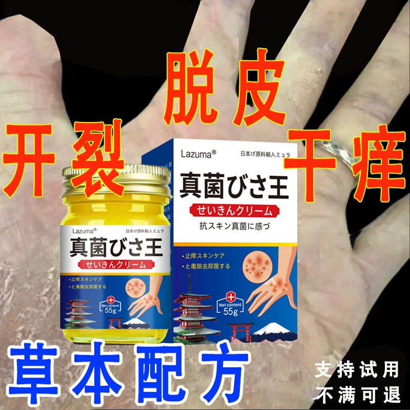 【真菌王】手足干裂脱皮克星草本抑菌膏四季修护神器抑菌止痒涂抹膏