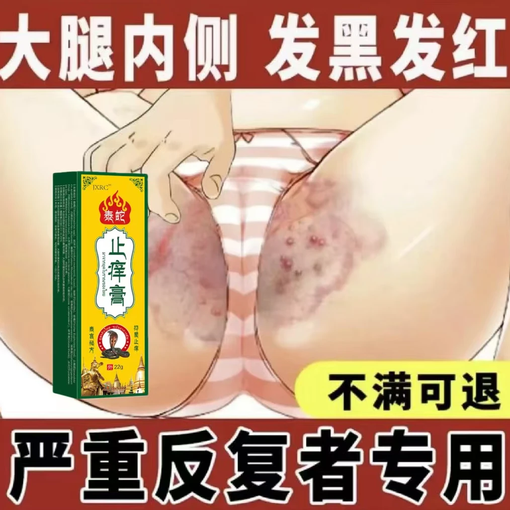 大腿内侧阴囊湿痒异味难闻越抓越痒男女同款全身可用止痒乳膏