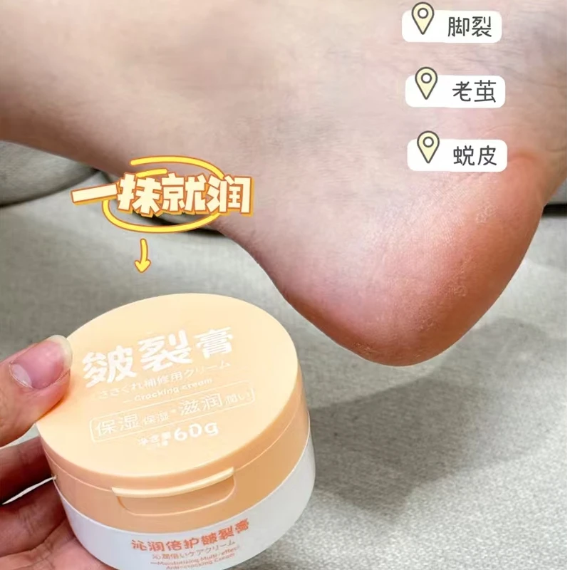 C009#修复干裂！养护白嫩光滑！60g皴裂膏【拆封不退】